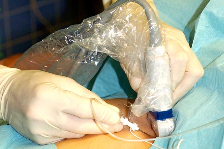 تخصص التخدير في ألمانيا