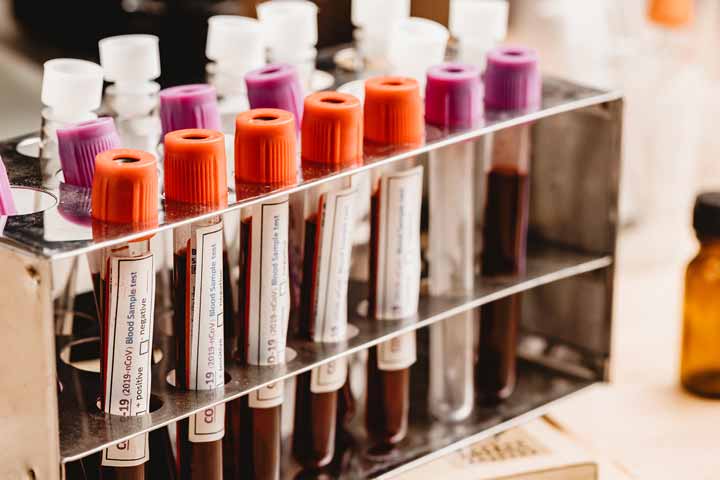 تخصص المختبرات في ألمانيا