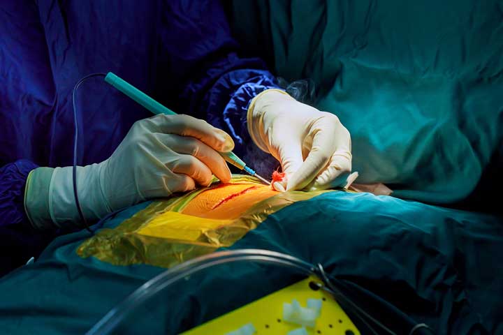 تخصص الجراحة في ألمانيا تخصص الجراحة في ألمانيا